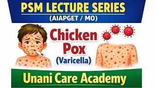 PSM Lecture Series٫ Topic-2 Chickenpox (Varicella) 