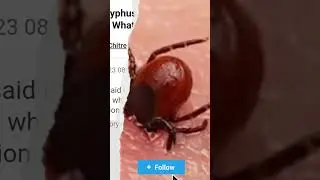 Scrub Typhus: The Disease Causing Deaths in India #news