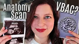 IUGR Again? Echocardiogram Results | 2nd Trimester Pregnancy Update  | IVF | High Risk