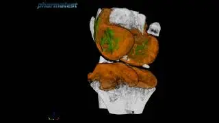 Micro-computed tomography (&micro;CT) of knee joint