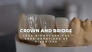 Crown and Bridge | Lec 4 Biomechanical considerations of fixed partial dentureكراون وبرج مرحلة خامسة