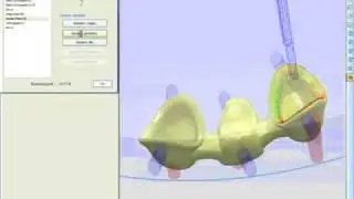 CAD CAM Dental schlichten innen Simulation 320