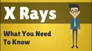 X Rays - What You Need To Know