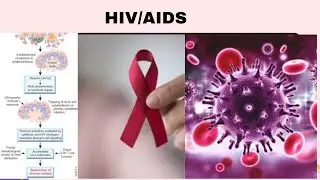 essay on what is HIV AIDS is causes and Treatment in ENGLISH/Symptoms of HIV AIDS Iin simple way/HIV