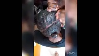 JINSI YA KUWEKA DAWA YA BOX(OLIVE OIL)