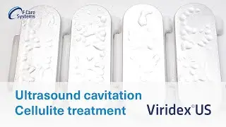Ultrasound cavitation cellulite treatment - Viridex&reg;US (F Care Systems)