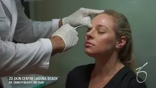 Botox for Forehead at ZO Skin Centre