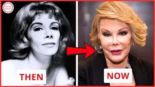35 Celebrities Who Went Too Far with Plastic Surgery | Then and Now 2026