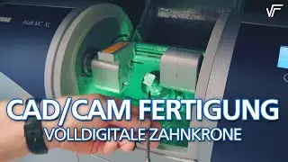 Computergest&uuml;tzte Fertigung von Zahnersatz / Keramikkronen durch CEREC / 3DSHAPE gefertigt