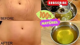 How to make an effective herbal stretch mark solution from home. |Make money with this product|