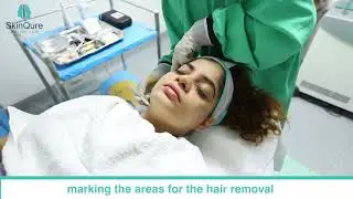 Facial Laser Hair Removal @SkinQure Clinic, Saket by Dr. Jangid |  Review by Prachi Kapoor