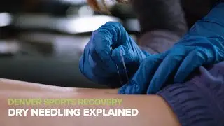 Denver Sports Recovery - Dry Needling Explained