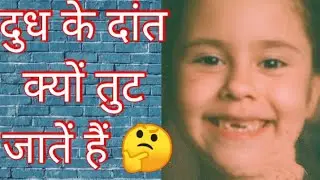दुध के दांत क्यों तुट जातें हैं /Why do milk teeth break out #shorts