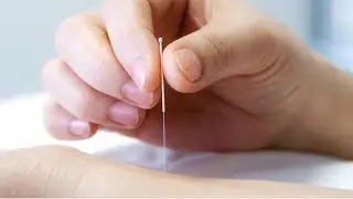 TREATMENT PRINCIPLES REVIEW 10: Acupuncture Treatment of Disease