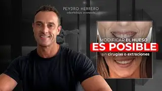 Cómo resolver SIN EXTRACCIONES NI CIRUGÍA una clase II extrema - Clínica Peydro