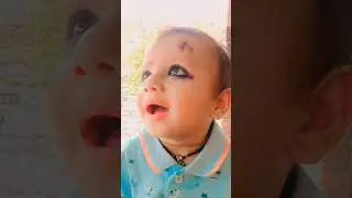 opretion sinoor #comedy #funny #jokes #fun #youtubeshorts #cutekids #cute #trandingshorts #baby #aru