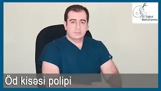 &Ouml;d kisəsi poliplərinin m&uuml;alicəsi