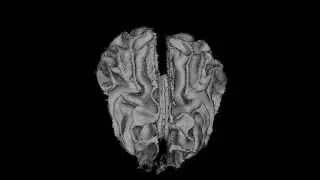 3D Reconstruction of the dog brain - White Matter and Amygdala