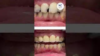Ensuring Your Bright  | Dr. Amar Jaswani M.D.S. 