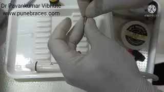How to use regular ultrasonic scaler tip for endodontic irrigation with 0.30mm wire: Part 4