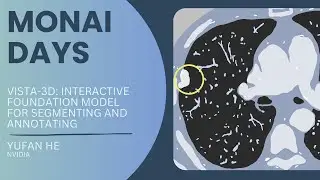 VISTA-3D: Interactive Foundation Model for Segmenting and Annotating Anatomies