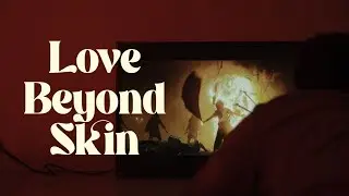 Love Beyond Skin | A Heartfelt Story of Beauty, Confidence & Love