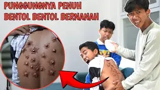 YA AMPUN ARIK KENA C4CAR AIR SAMPE BEGINI BADANNYA??😱SAPUTRA PANIK! | Mikael TubeHD