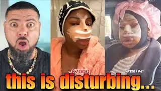 Are Black Women REALLY Going This Far To Be Pretty?