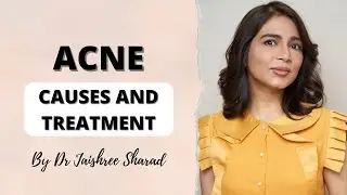 Acne | Pimples | Blackheads | Whiteheads | Causes and Treatment | By Dr Jaishree Sharad