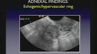 Female Pelvis Ultrasound cases