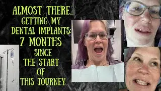 The BIG DAY:  #dentalimplantsurgery time after 7 months of work to get to this point *not* graphic!