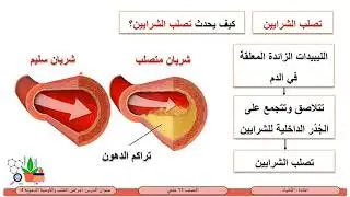الصف الثاني عشر   المسار العلمي   الأحياء   أمراض القلب و الأوعية الدموية و الوقاية منها 4