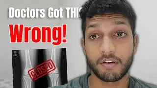 Watch This If Your Growth Plates are CLOSED (for 18+)