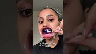 How to white your teeth at home?? how to get white teeth??