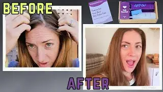 Madison Reed Hair Color Kit: A Salon-Quality Dye at Home