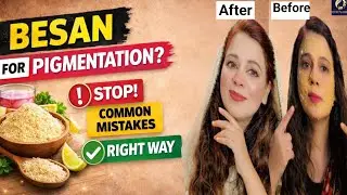 STOP Using Besan for Pigmentation ❌ | Common Mistakes & Right Way | Wish Beauties