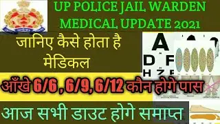 UP POLICE JAIL WARDEN / FAIRMAN MEDICAL UPDATE TODAY 202Q . MEDICAL ME KYA KYA CHECK HOTA HE.