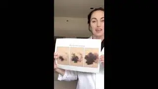 Advanced Tip #2 - ABCDE's of Melanoma - Advanced Dermatology Care