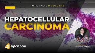 Hepatocellular Carcinoma | Medicine Student | Medical Lecture | V-Learning&trade; | TRAILER