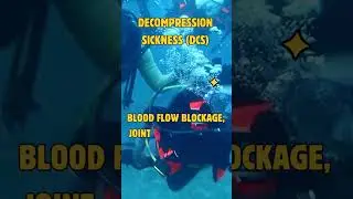 Decompression Sickness Can Be Fatal &ndash; Know the Signs  #shorts #shortvideo #video #DCS #DiveSafety