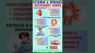 Warning Signs That Your Body is Lacking Vitamins and Minerals