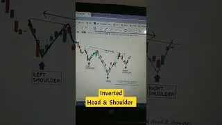 HDFC STOCK ANALYSIS