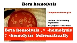 Microbiology: Beta hemolysis, &alpha;-hemolysis, &gamma;-hemolysis