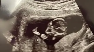 Pregnancy Update| Finding Out until Now 18weeks #pregnancy #covid #maternit21