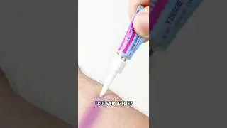 Клей для кожи может ТАКОЕ?! 🤯 #клей #шов #заживлениеран #уходзакожей