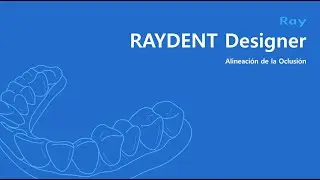 RAYDENT Designer: Alineaci&oacute;n de la Oclusi&oacute;n