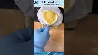 Primary cast for complete edentulous Denture | primary cast making