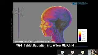 Cell Phone and Wireless Radiation Exposure and Health