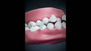 DentalMonitoring Plus