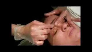 dermaplaning / epidermal leveling Spa Catalina